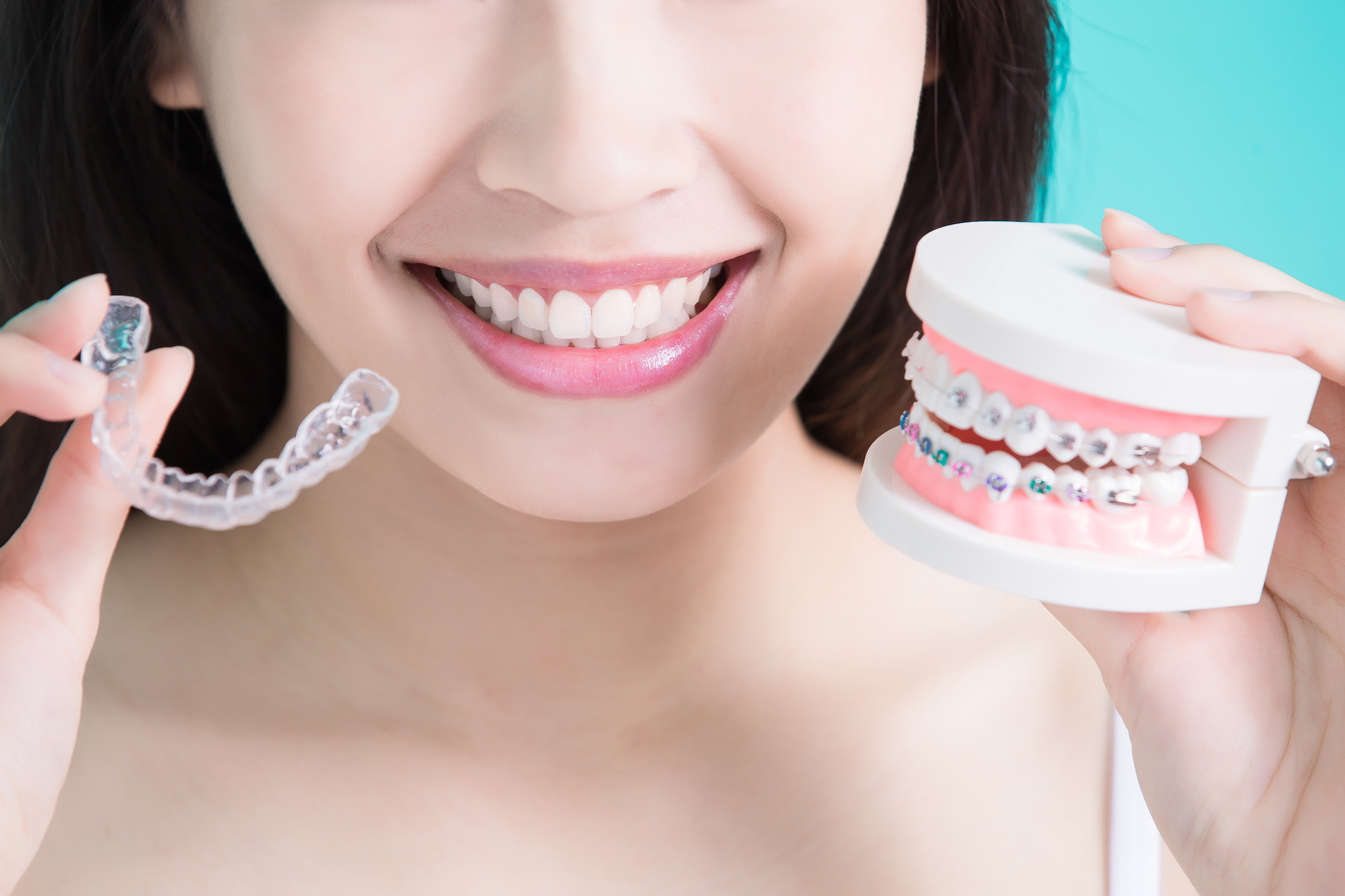 歯列矯正の選択肢イメージ